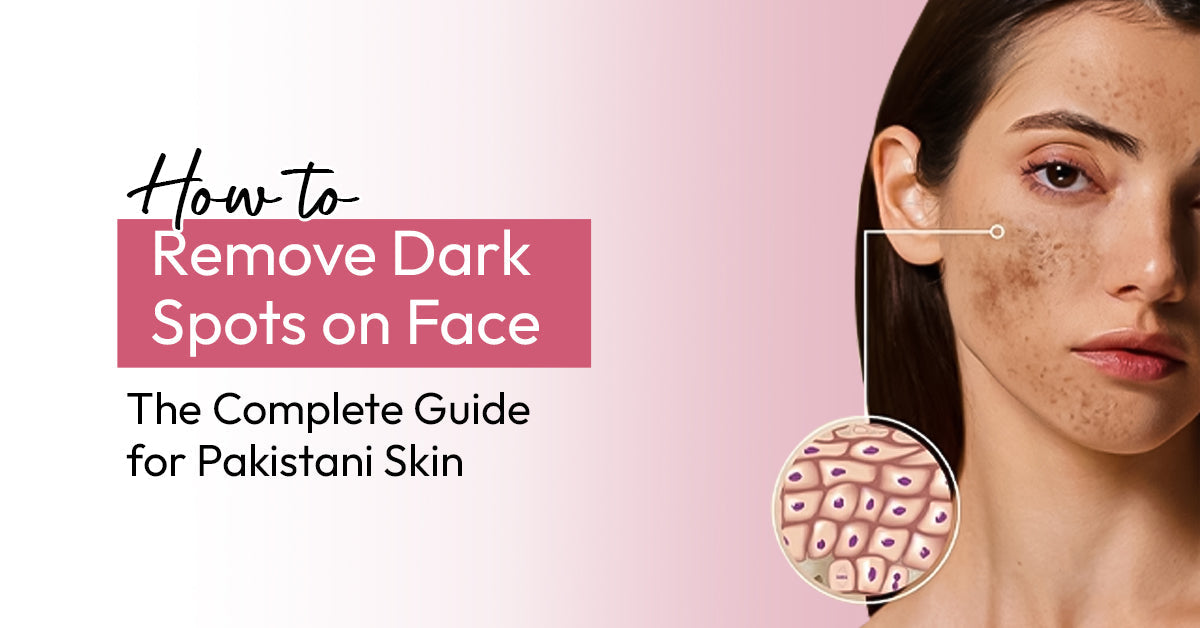 how to remove dark spot on face