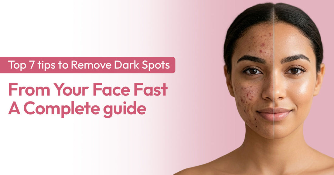 tips to Remove Dark Spots 