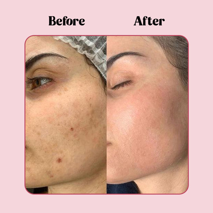 Sensibio H2O Blemish Control Cleanser